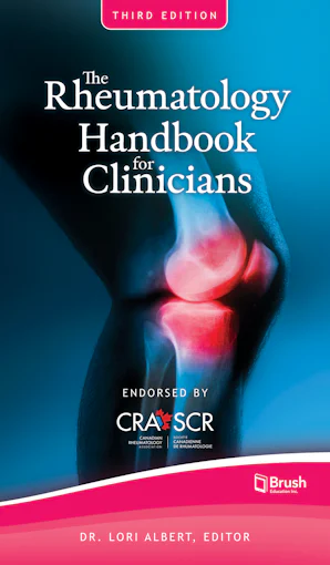 Pocket Rheumatology The Rheumatology Handbook for Clinicians